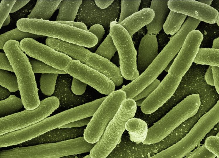 Primer plano de un grupo de bacterias.