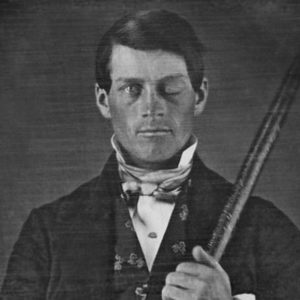 Phineas Gage.