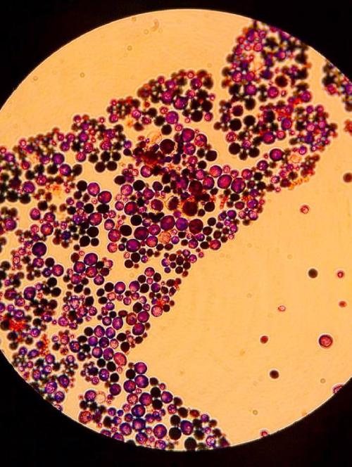 Candida albicans, uno de los hongos microscópico.