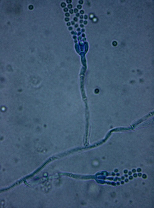 Penicillium spp.
