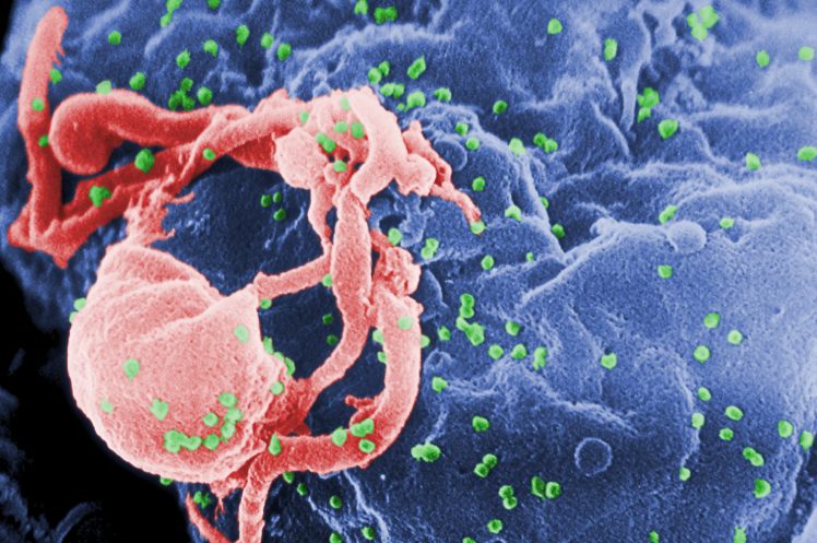 Microfotografía del VIH en liberación